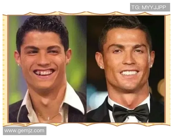 足球明星正畸前后对比高清图片展示与分析 足球明星正畸前后对比高清图片展示与分析